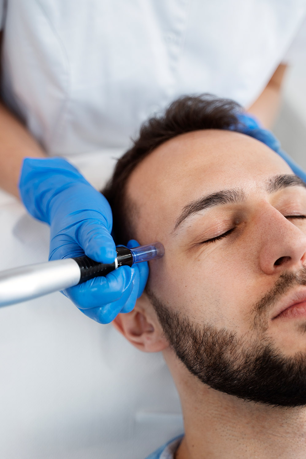 Mesoterapia Facial para Hombres: Innovación y Eficacia